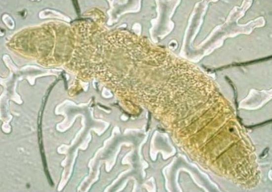 Представитель Семейства Antelientomidae